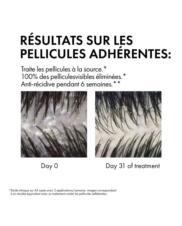 VICHY DERCOS OFFRE SHAMPOING ANTI PELLICULAIRE DS CHEVEUX SECS 200 ML + SHAMPOING FORMAT VOYAGE 50 ML OFFERT
